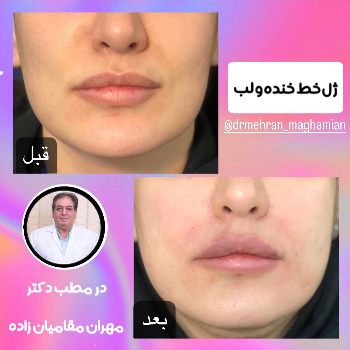 دکتر مهران مقامیان زاده پزشک میکرودرم| بهترین دکتر میکرودرم در تهران