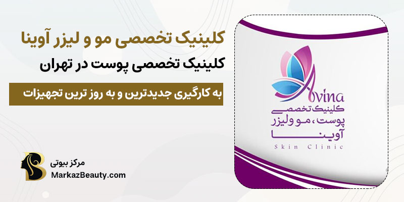 کلینیک پوست آوینا مرکز تخصصی کربوکسی تراپی در تهران| بهترین مرکز کربوکسی تراپی در تهران
