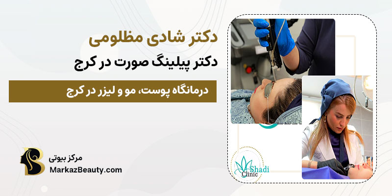 دکتر شادی مظلومی متخصص پیلینگ صورت در کرج | بهترین مرکز پیلینگ در کرج