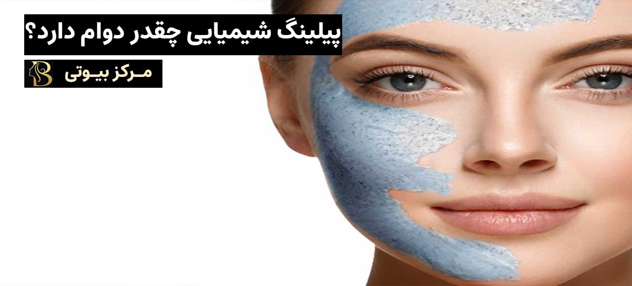 پیلینگ شمیایی چقدر دوام دارد؟ | مرکز بیوتی