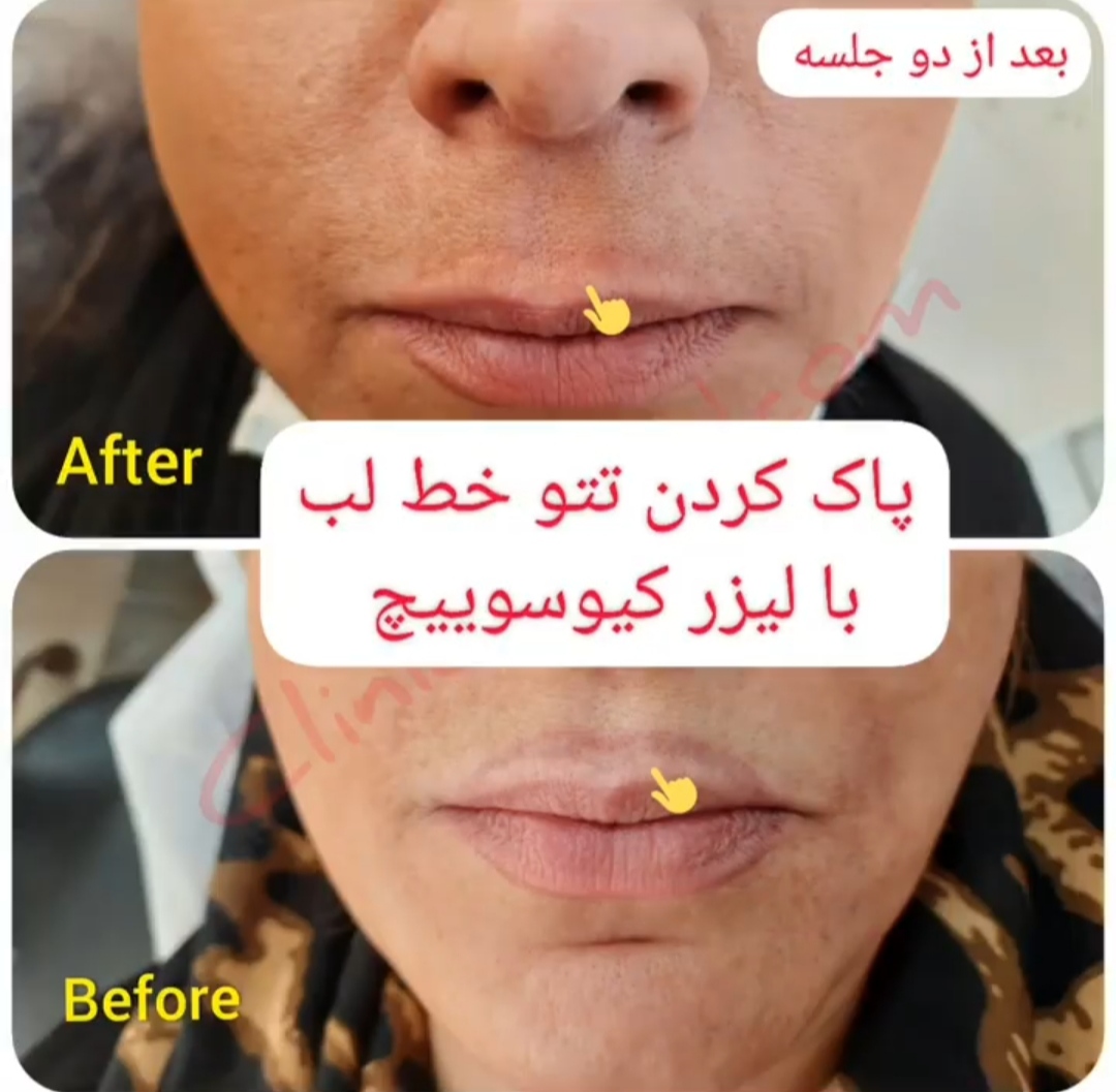 کلینیک تخصصی ارکید مرکز میکرودرم| بهترین کلینیک میکرودرم در تهران