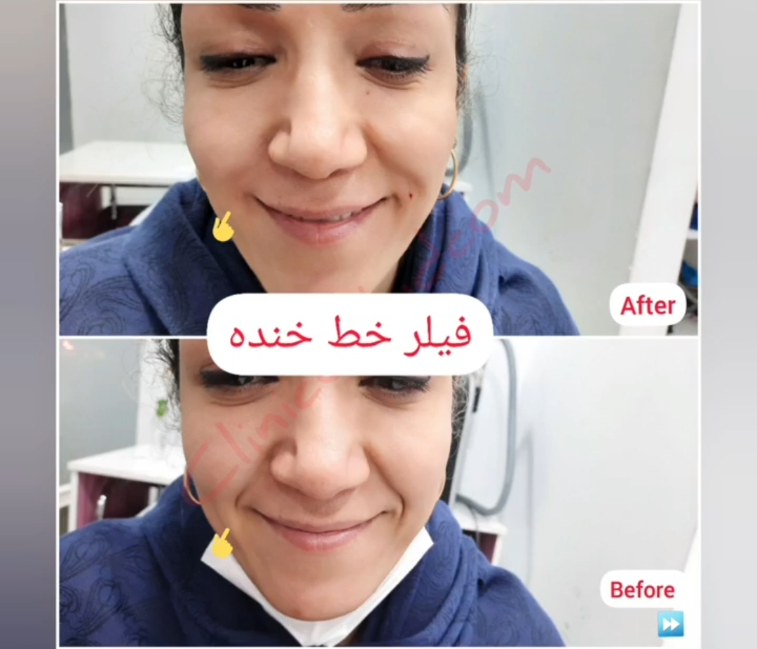 کلینیک تخصصی ارکید مرکز میکرودرم| برجسته ترین کلینیک میکرودرم در تهران