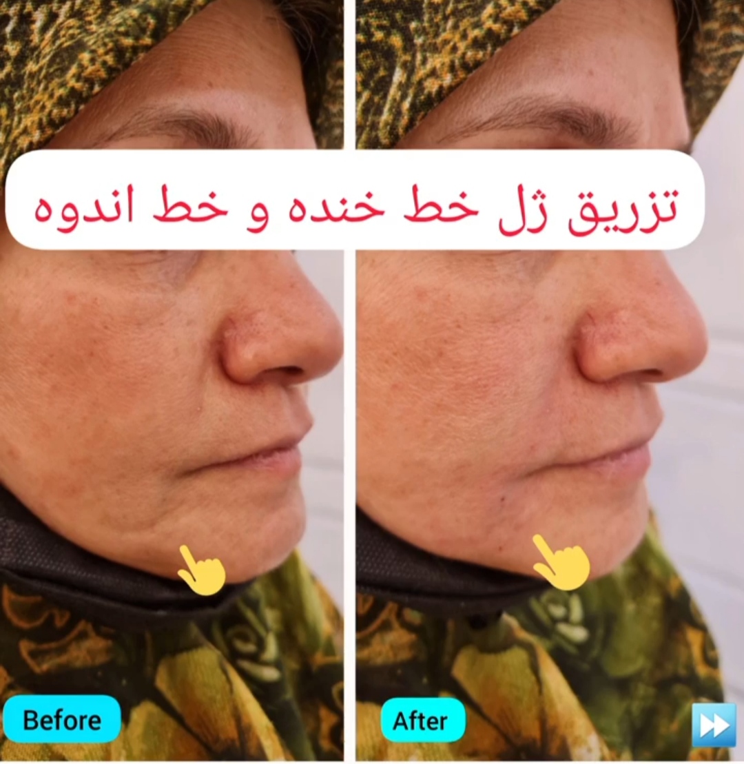 کلینیک تخصصی ارکید مرکز میکرودرم| بهترین کلینیک میکرودرم در تهران