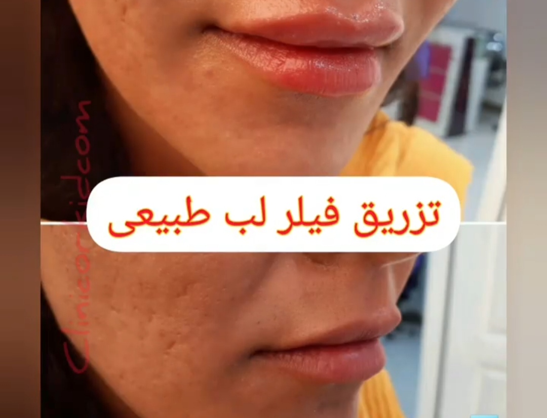 کلینیک تخصصی ارکید مرکز میکرودرم| بهترین کلینیک میکرودرم در تهران