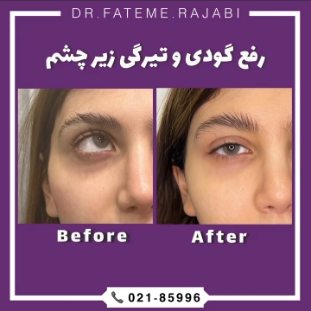 دکتر فاطمه رجبی بهترین مطب پیلینگ در تهران |بهترین کلینیک پیلینگ در تهران