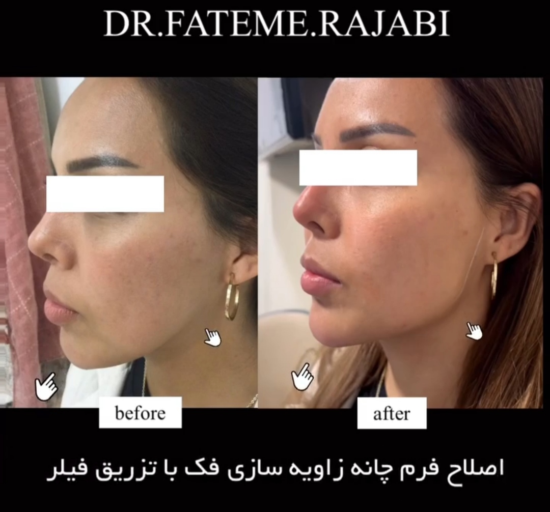 دکتر فاطمه رجبی بهترین مطب پیلینگ در تهران |بهترین متخصص پیلینگ در تهران