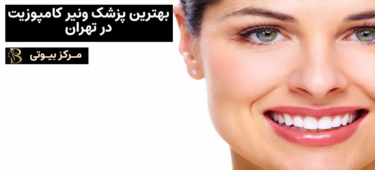 بهترین متخصص ونیر کامپوزیت در تهران | مرکز بیوتی