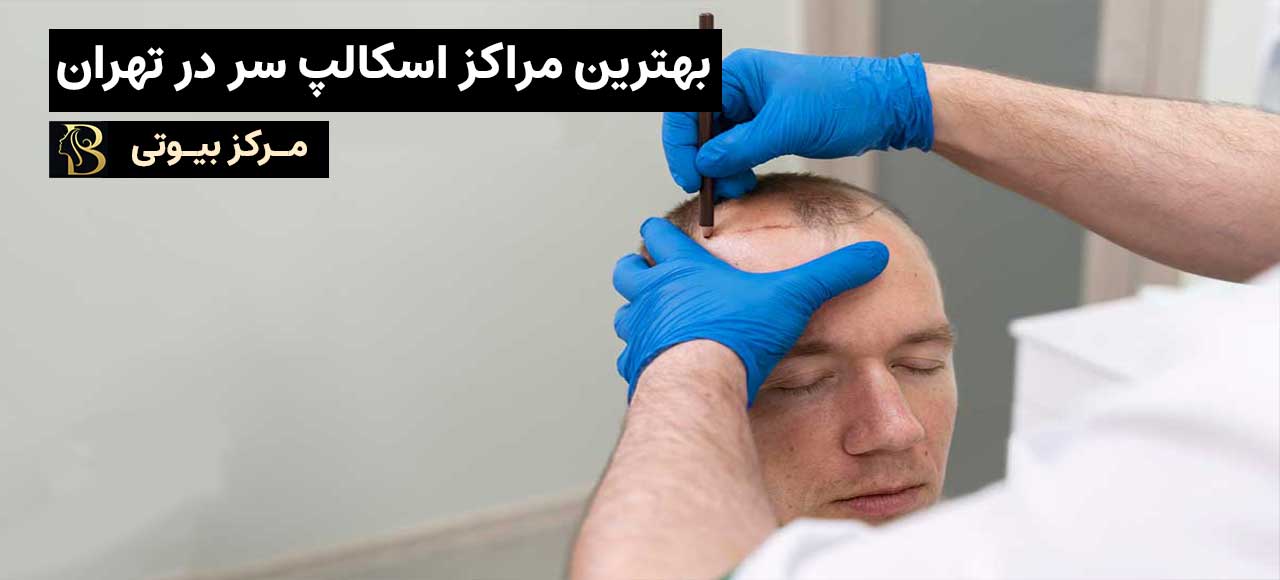بهترین متخصص اسکالپ سر در تهران | مرکز بیوتی