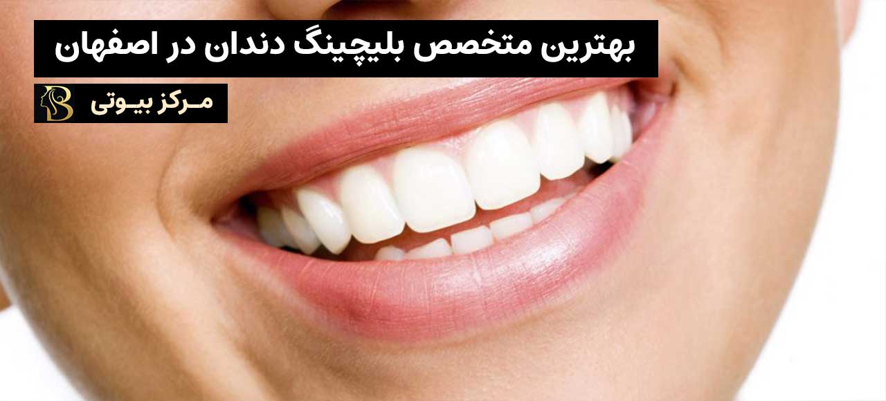 بهترین متخصص بلچینگ دندان در اصفهان | مرکز بیوتی