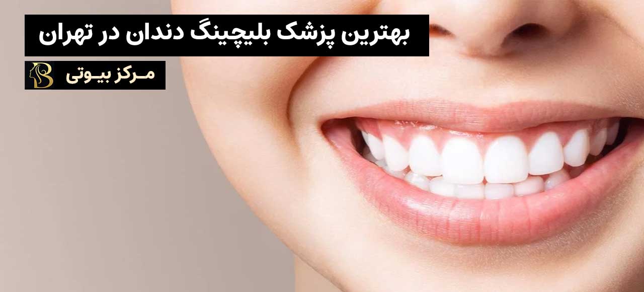 بهترین متخصص بلچینگ دندان در اصفهان | مرکز بیوتی