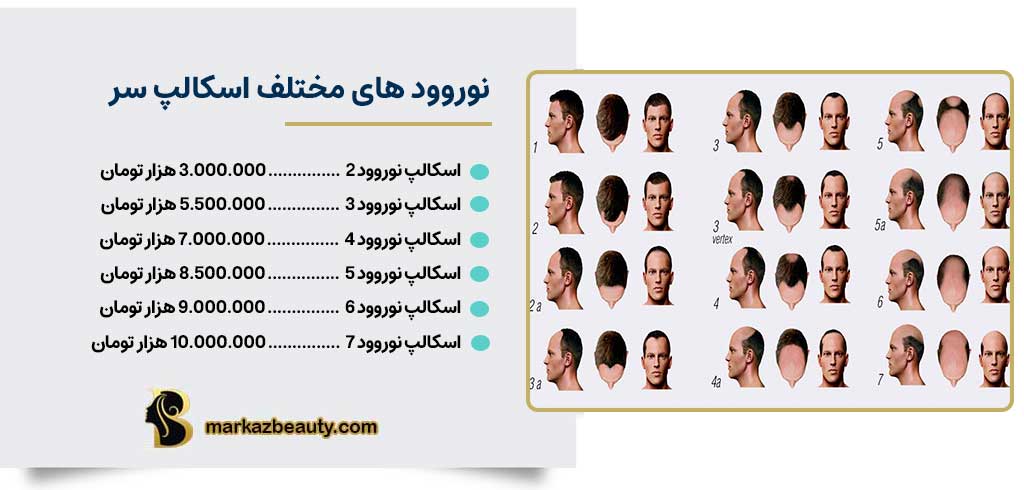نوورد های مختلف اسکالپ سر | مرکز بیوتی