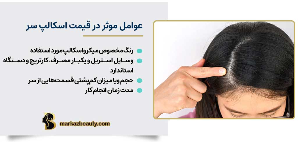 عوامل تاثیر گذار بر قیمت اسکالپ سر در تهران | مرکز بیوتی