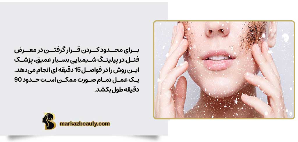 آنچه در طول پیلینگ صورت باید انتظار داشته باشید | مرکز بیوتی