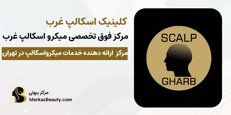 کلینیک تخصصی اسکالپ غرب متخصص اسکالپ سر | بهترین کلبنبک اسکالپ سر در تهران
