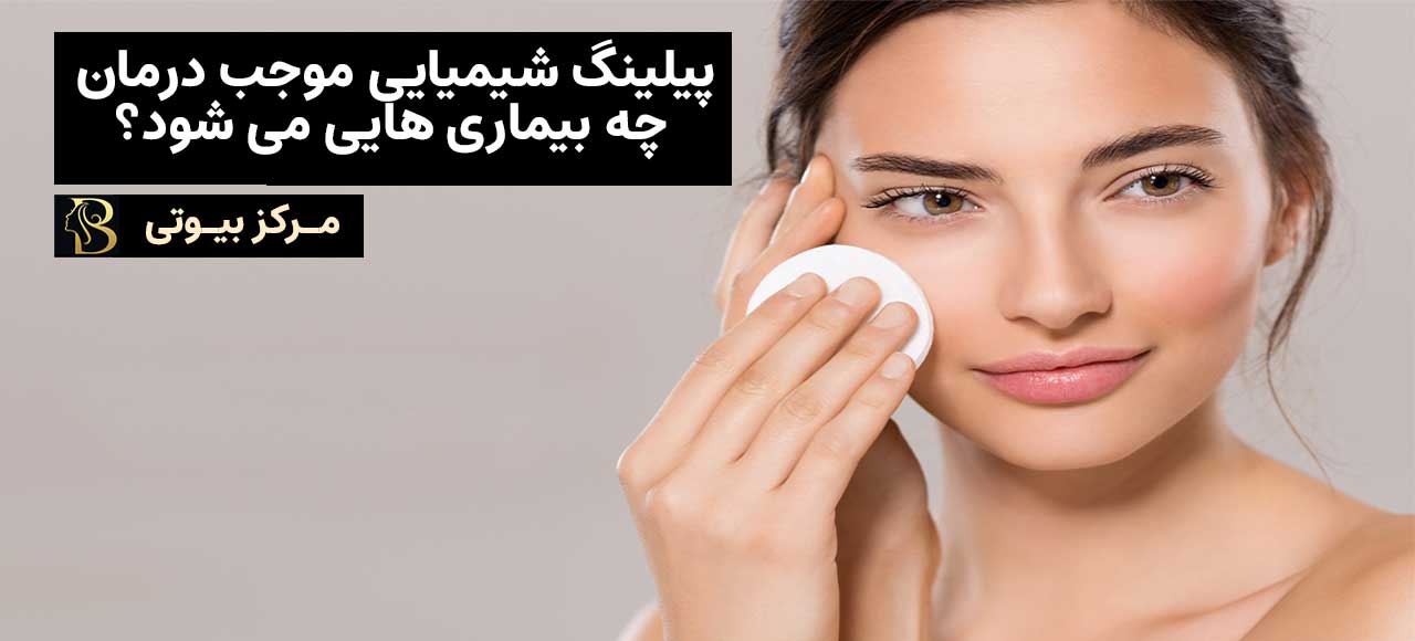 مزایای پیلینگ شیمیایی | مرکز بیوتی