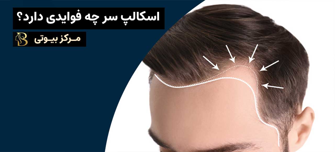 فواید اسکالپ سر چیست؟ | مرکز بیوتی