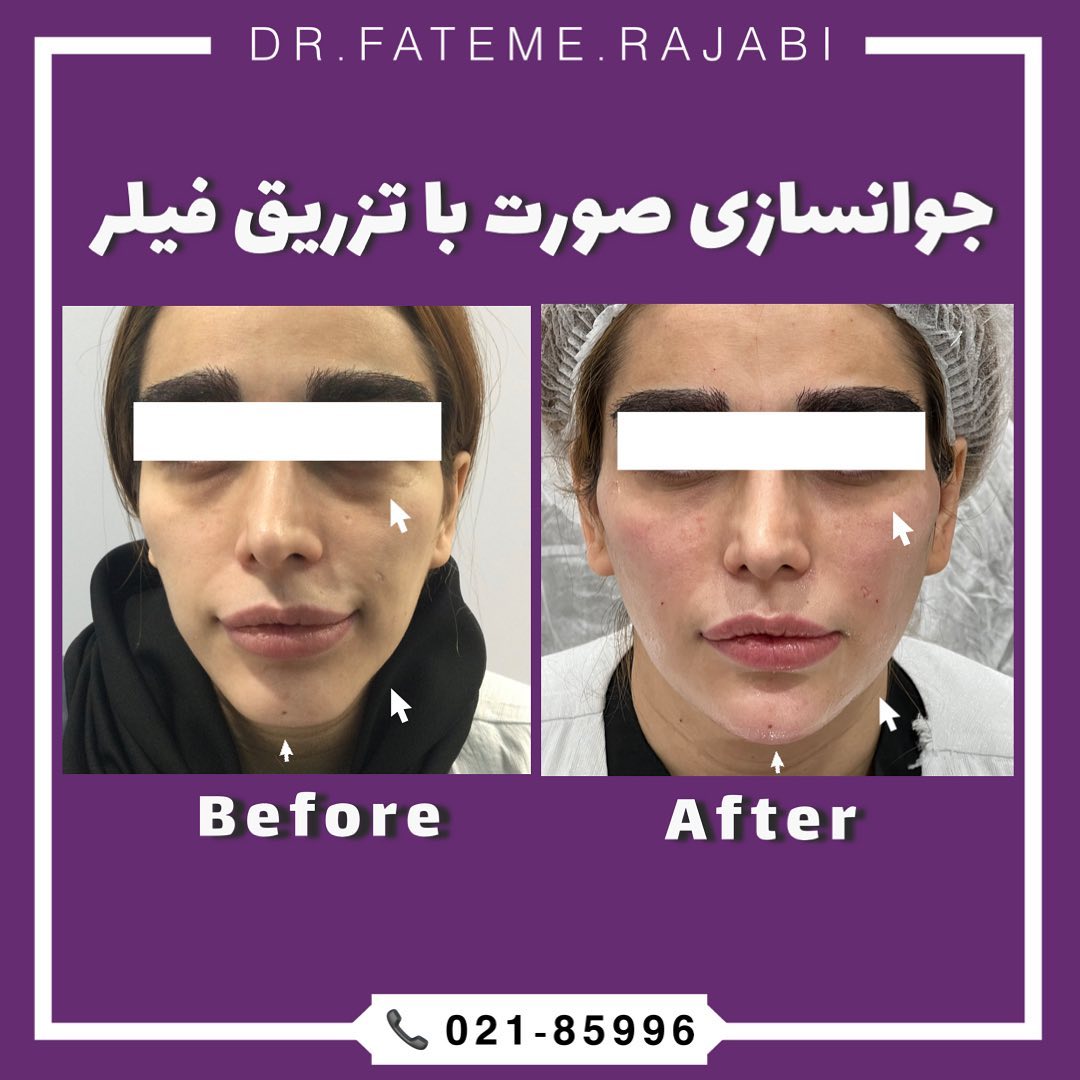 دکتر فاطمه رجبی بهترین مطب پیلینگ در تهران |بهترین کلینیک پیلینگ در تهران