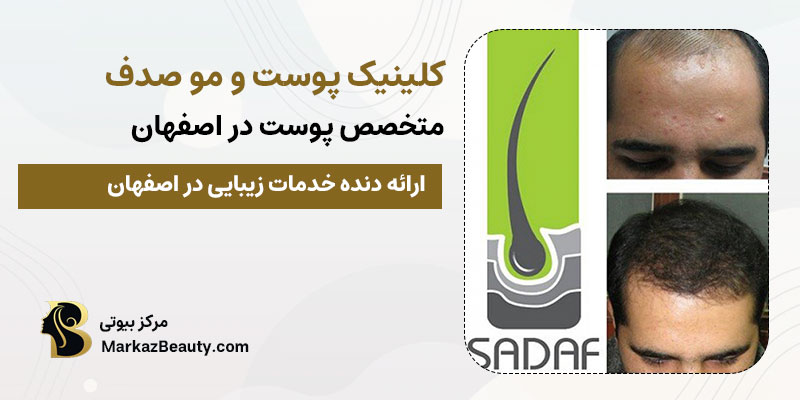 کلینیک پوست و مو صدف | بهترین مرکز پوست و مو در اصفهان