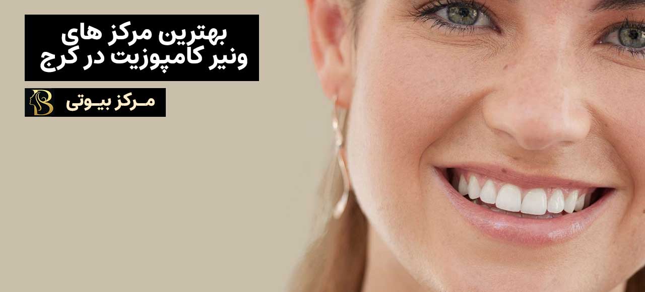 بهترین مراکز ونیر کامپوزیت کرج | مرکز بیوتی