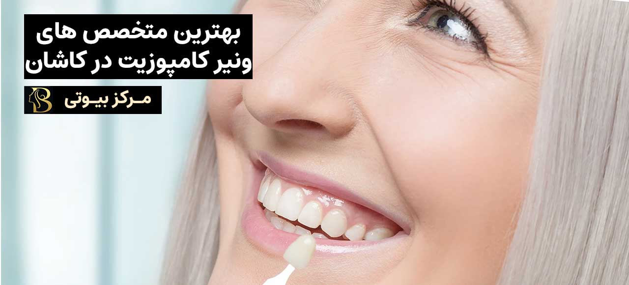 بهترین متخصص ونیر کامپوزیت در کاشان | مرکز بیوتی