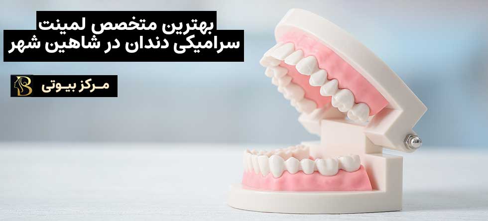 بهترین متخصص لمینت سرامیکی دندان در شاهین شهر | مرکز بیوتی