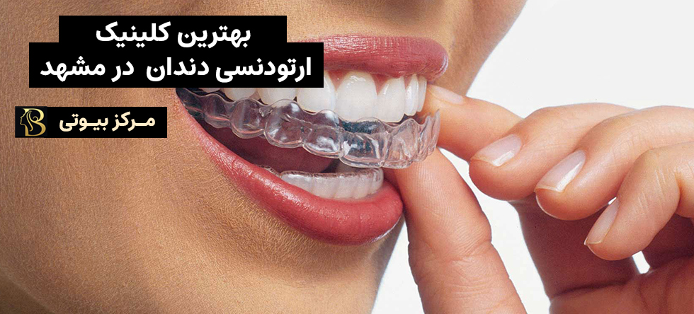 بهترین کلینیک ارتودنسی مشهد | مرکز بیوتی