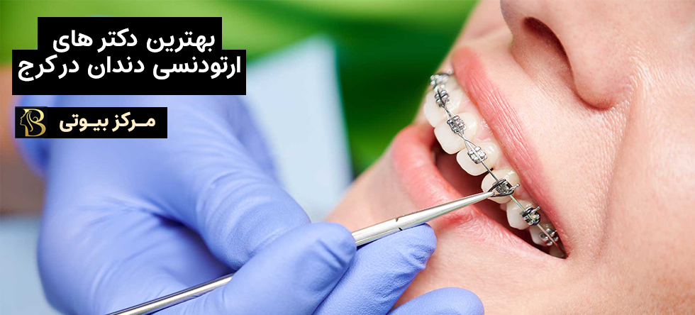 بهترین دکتر های ارتودنسی دندان در کرج | مرکز بیوتی