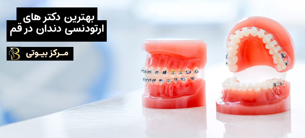 بهترین دکتر ارتودنسی در قم | مرکز بیوتی
