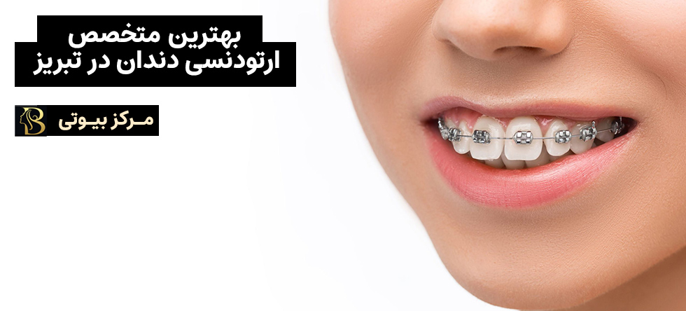 بهترین متخصص ارتودنسی دندان در تبریز | مرکز بیوتی