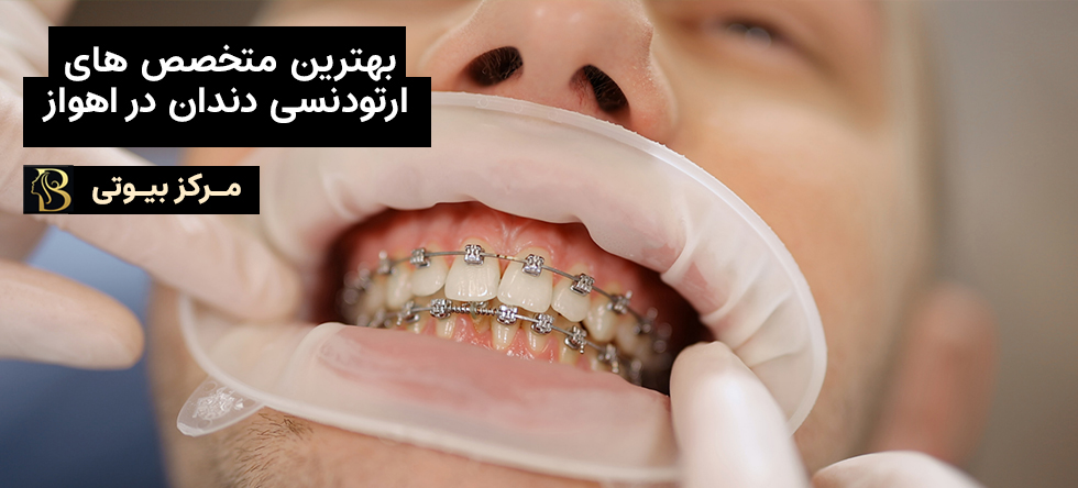بهترین دکتر ارتودنسی اهواز | مرکز بیوتی