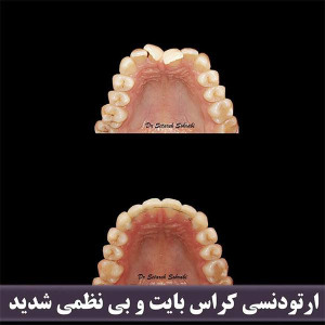 نمونه کار مطب دندانپزشکی دکتر ستاره سهرابی | بهترین دکتر ارتودنسی دندان کرج