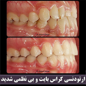 گالری تصاویر کلینیک دندانپزشکی دکتر ستاره سهرابی | بهترین مرکز ارتودنسی دندان کرج