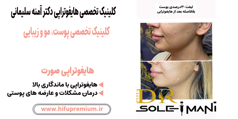عکس قبل و بعد از هایفوتراپی در کلینیک زیبایی دکتر سلیمانی_ هایفوپریمیوم