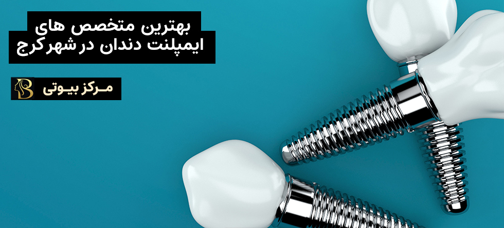 بهترین متخصص ایمپلنت کرج | مرکز بیوتی