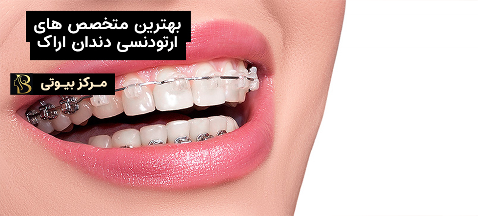 بهترین دکتر ارتودنسی اراک | مرکز بیوتی