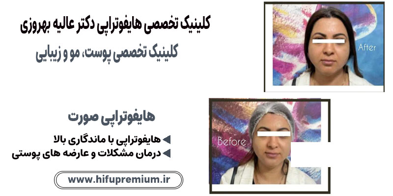 کلینیک زیبایی دکتر عالیه بهروزی، متخصص پوست مو و هایفوتراپی در بیرجند