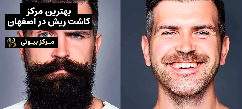 کاشت ریش در اصفهان | مرکز بیوتی