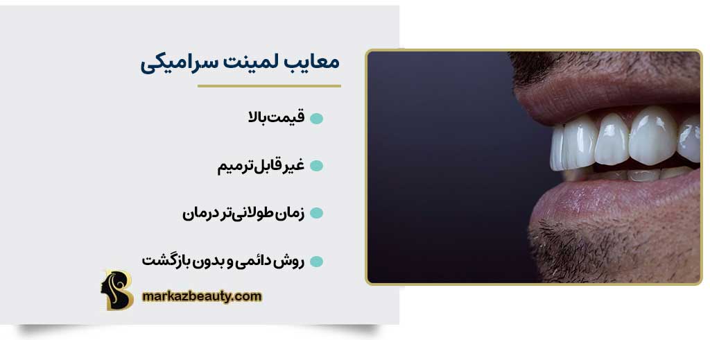 معایب لمینت سرامیکی دندان | لمینت بهتر است یا کامپوزیت دندان؟