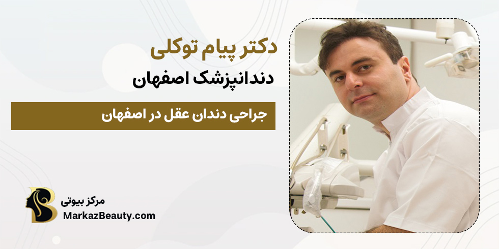 دکتر پیام توکلی | دکتر کشیدن دندان عقل اصفهان
