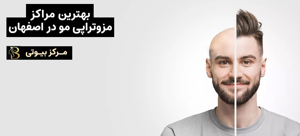 مزوتراپی مو در اصفهان | مرکز بیوتی
