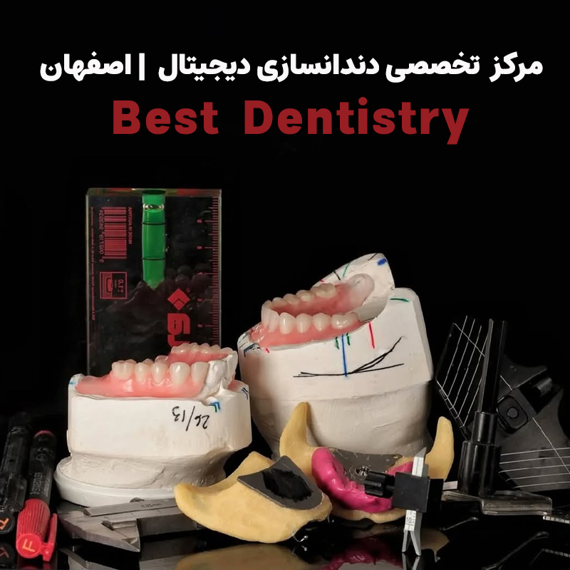 بهترین دندانسازی دیجیتال در اصفهان