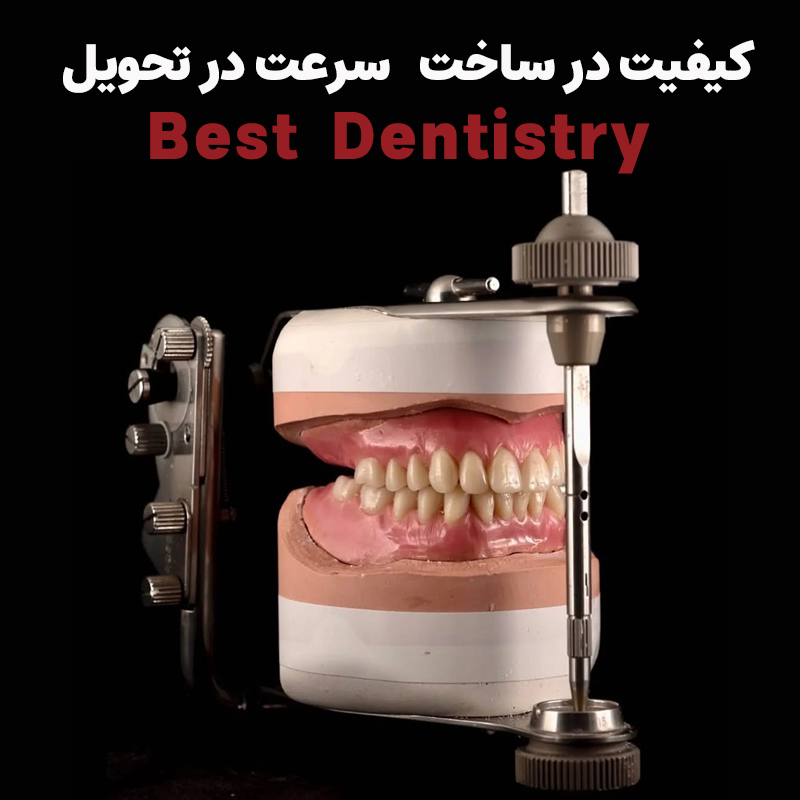 بهترین دندانسازی دیجیتال در اصفهان
