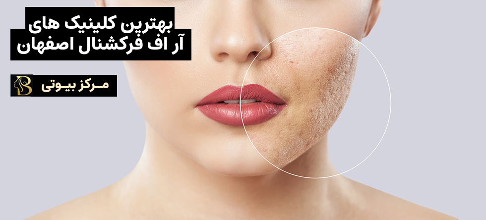 آر اف فرکشنال اصفهان | مرکز بیوتی