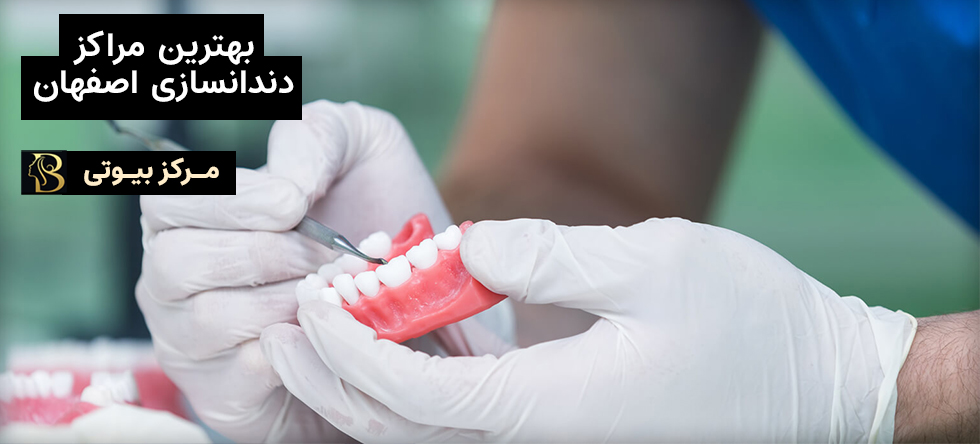 بهترین مراکز دندانسازی اصفهان | مرکز بیوتی