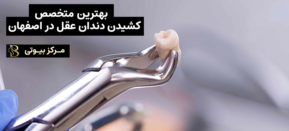 بهترین دکتر کشیدن دندان عقل در اصفهان | مرکز بیوتی