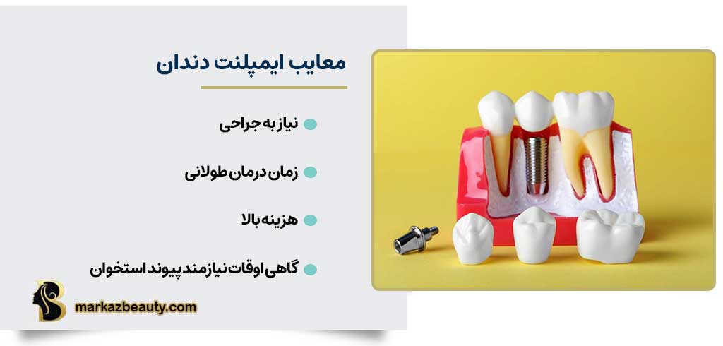 معایب ایمپلنت دندان | مرکز بیوتی
