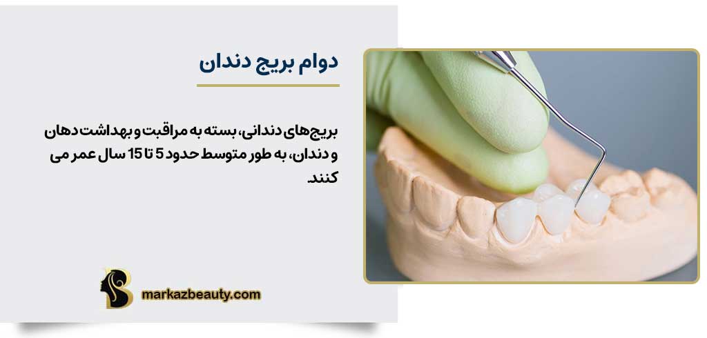 دوام بریج دندان | مرکز بیوتی