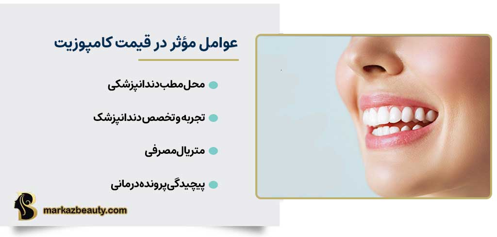 عوامل مؤثر در قیمت کامپوزیت دندان | قیمت کامپوزیت اصفهان