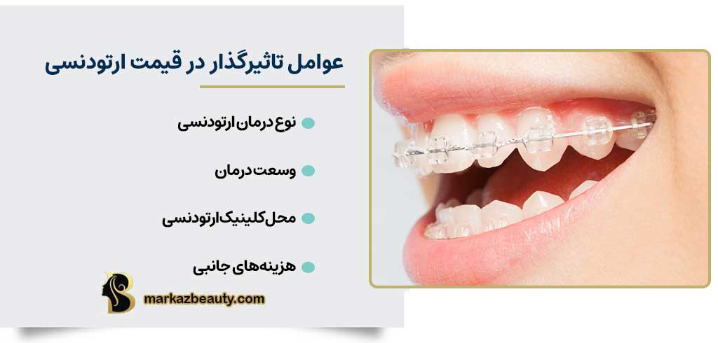 عوامل موثر بر قیمت ارتودنسی | مرکز بیوتی