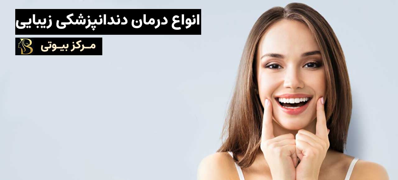 انواع درمان های دندانپزشکی زیبایی | مرکز بیوتی